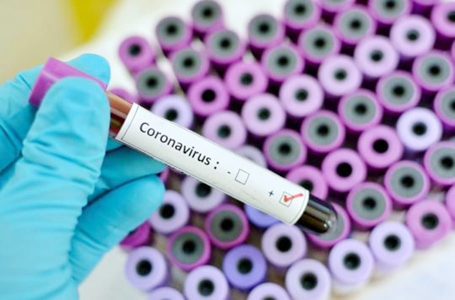 Read more about the article CORONAVIRUS: 906 persoane infectate, la nivel naţional