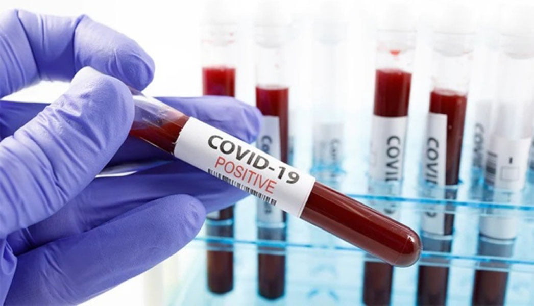 Read more about the article Care este situaţia cazurilor de infectare cu COVID-19 la nivelul judeţului