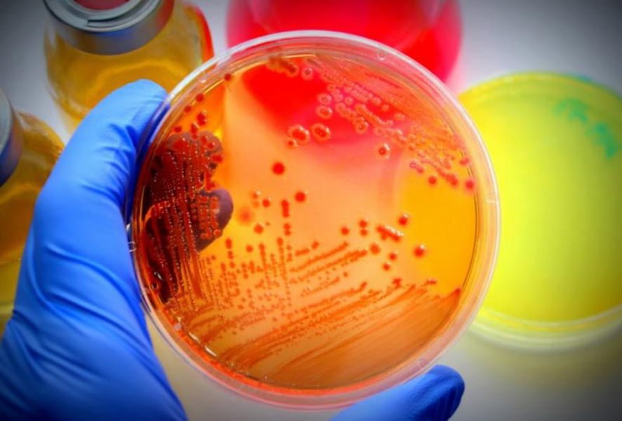 Read more about the article Ce se întâmplă cu virusul vara? Epidemiolog: Nu moare, dar nici nu se simte confortabil pe un volan încins de soare