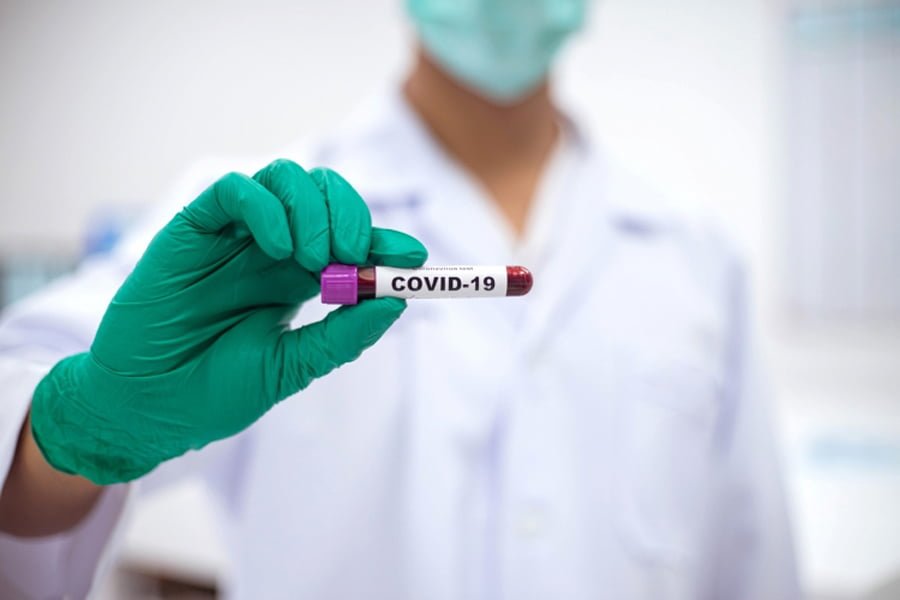 Read more about the article Coronavirus în România: 307 cazuri noi și 39 de decese, în ultimele 24 de ore