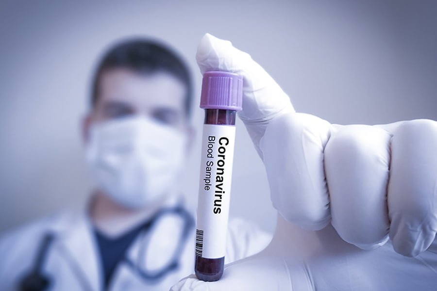 Read more about the article CORONAVIRUS în România: 416 noi infectări și 23 de decese în ultimele 24 de ore