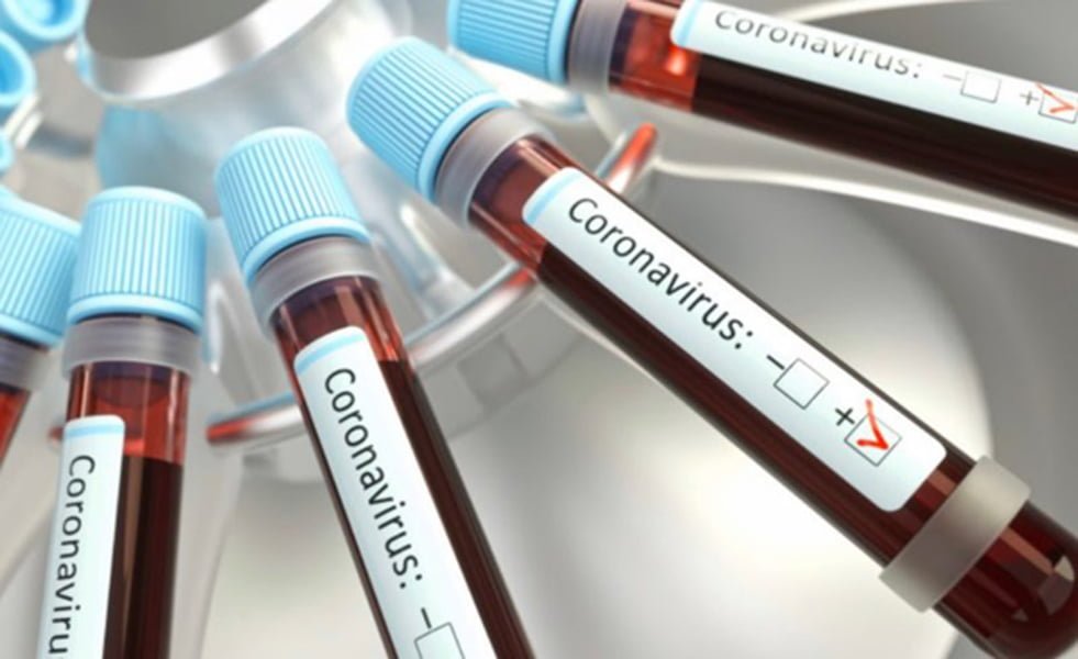Read more about the article CORONAVIRUS în România: 28.973 de infecții și 1.750 de persoane decedate din cauza COVID-19