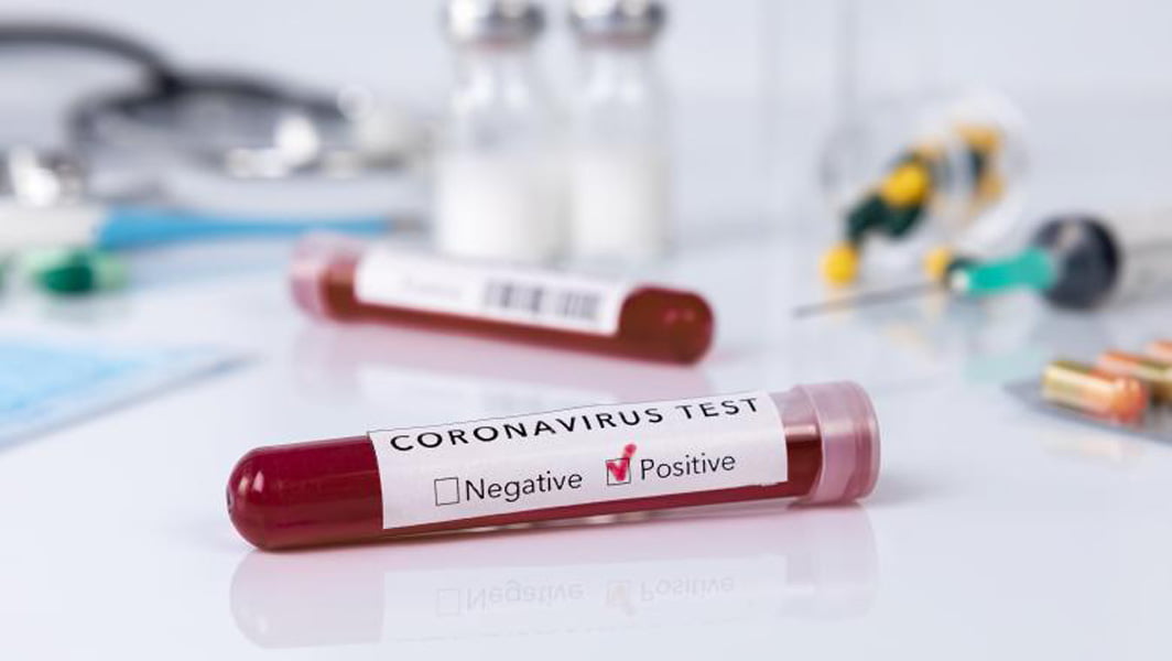 Read more about the article CORONAVIRUS în România: Încă 174 de decese cauzate de infecţia cu COVID-19