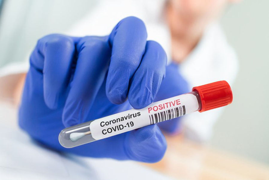 Read more about the article Coronavirus în România: Rată de infectare de 0,44% în ultimele 24 de ore