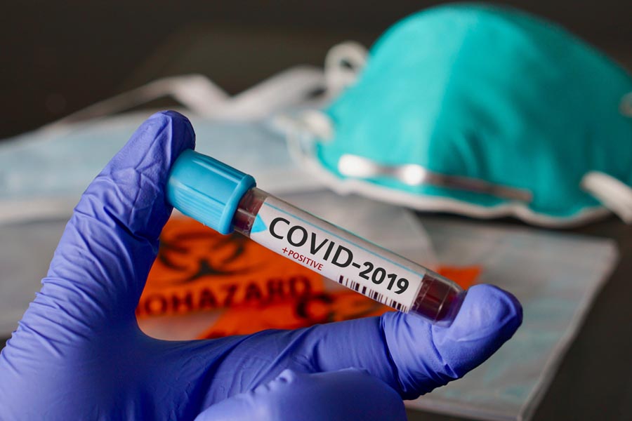 Read more about the article Coronavirus în România: 140 de cazuri noi și 14 decese
