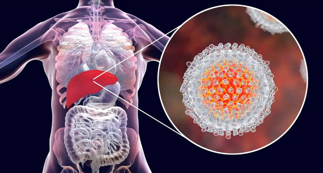 Read more about the article Ziua Mondială de Luptă împotriva Hepatitei – 28 iulie